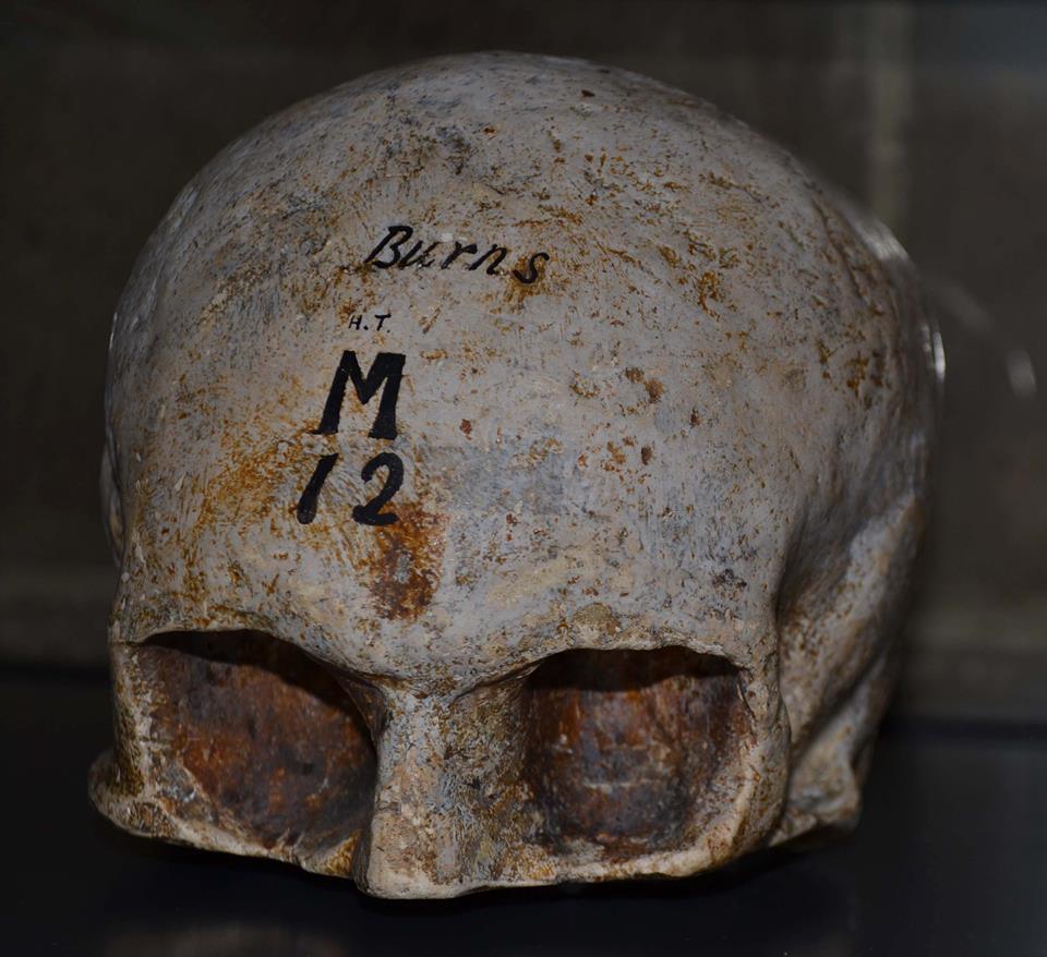 Cast of the skull of Robert Burns